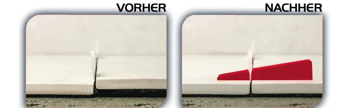 Nivofix Keile (Wedges) 100 Stk. 1